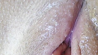 A Swollen Clitoris Looks Even Fleshier up Close