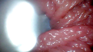 First time: An endoscope reveals the G-spot up close - without mountingl