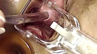 Extreme Pussy Play with Speculum and Peehole Fuck