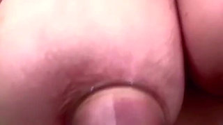 Nipple Cupping and Extreme Milking