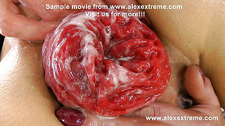 Extreme anal fisting, huge dildos and prolapse compilation from alexextreme 69-89