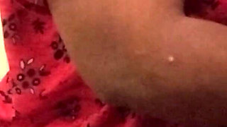 Hot Leg