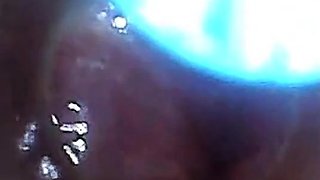 Endoscope POV Test Tube Cock Urethral Insertion