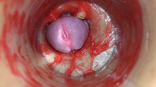 Camera Inside Deep Pussy Captures Very Huge Ejaculation of Sperm Asmr