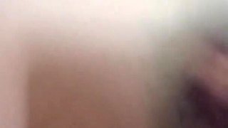 Margot Pees with a Big Bruise on Her Leg