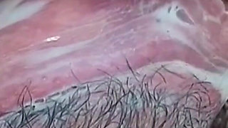 Selection of Vacuum Masturbation of the Vagina