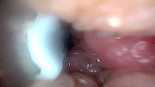 Visual Guide to G-Spot Stimulation and Orgasm - Endoscopic Perspective
