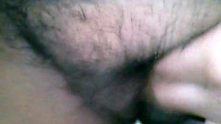 My hairy