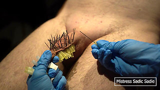 107 Needles CBT