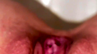 Lots of Peeing in Places