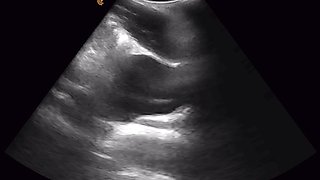 Something Was MOVING Inside His Belly!