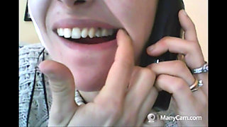 Chantal's Teeth Fall Apart, Rotten and Black