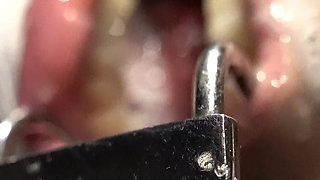 Spit and More Spit! Let Me Just Cover You!