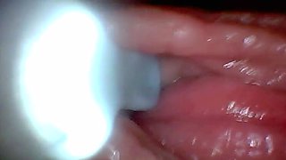 Teen POV: Endoscope G-Spot Close-Up – First Time Deep Pussy Exam