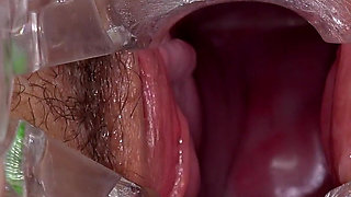 Hairy Mature Pussy Examined by Two Doctors